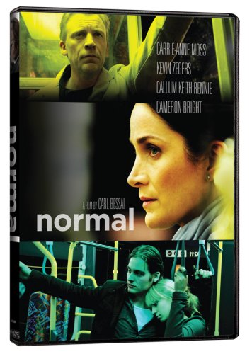 NORMAL