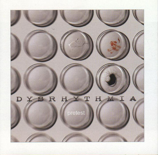 DYSRHYTHMIA  - PRETEST